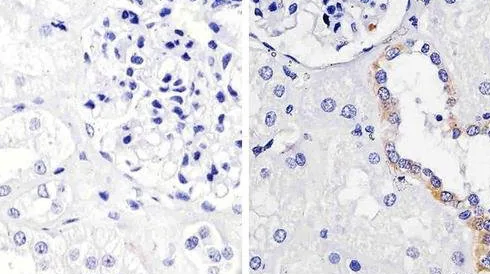 Primary Antibodies for ELISA