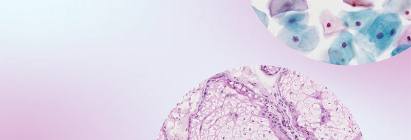 Webinar: Using Telepathology to Advance Patient Care and Lab Workflows